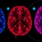 Getimg B7 H3 CAR T Cell Therapy Demonstrates Strong Safety Profile In Recurrent Glioblastoma Clinical Trial 1763789624