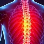 Getimg Nervgen Pharmas Nvg 291 Delivers Breakthrough Results In Chronic Spinal Cord Injury Treatment Clinical Trial Success And Fda Approval Pathways 1764021367