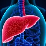 Getimg Surprisingly Common Liver Disease Affects 100 Million Americans The Hidden Health Crisis Unveiled 1764167363