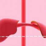 Getimg Surprisingly Common Liver Disease Affects Millions In The Us The Silent Health Crisis Gripping The Nation 1764167347