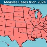 Getimg Us Measles Cases Top 1700 In 2024 Health News Headlines On Vaccines Healthcare Strain And Drug Price Pressures 1764167378