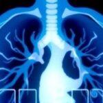 Getimg Va Urges Veterans Early Lung Cancer Detection With Ct Scans Dramatically Boosts Survival Rates 1763852931