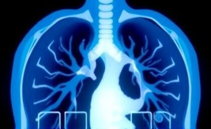 Getimg Va Urges Veterans Early Lung Cancer Detection With Ct Scans Dramatically Boosts Survival Rates 1763852931