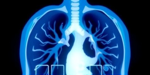 Getimg Va Urges Veterans Early Lung Cancer Detection With Ct Scans Dramatically Boosts Survival Rates 1763852931