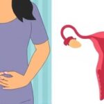Getimg Why We Fall Easily For False Health Info Medicalnewstoday Experts Debunk Ibs And Endometriosis Myths 1764167094